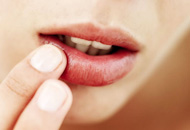 Stomatitis Treatments in Dubai