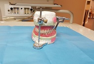 Jaw Implants in Dubai