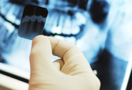 Dental Radiology in Dubai