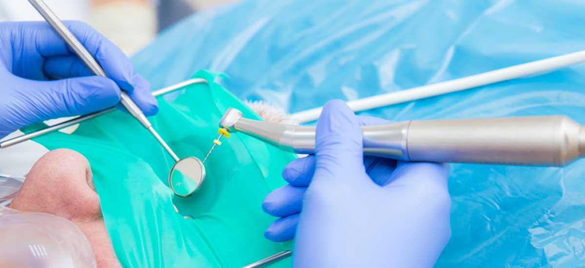 Root Canal Treatments in Dubai